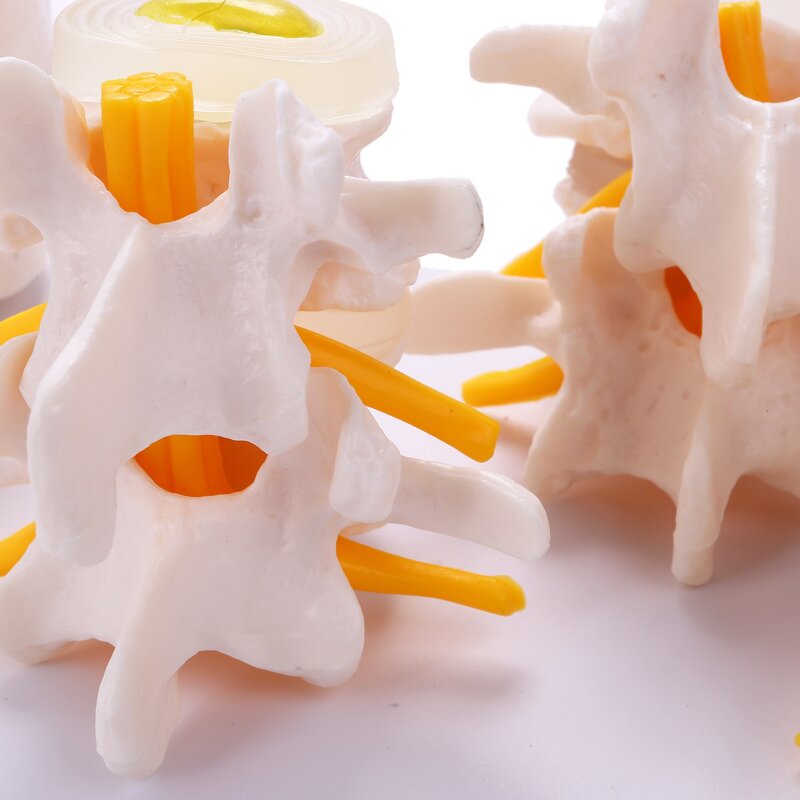 Human Anatomy Skeleton Spine 4-Stages Lumbar Vertebral Model Brain Skull Traumatic Teaching Supplies
