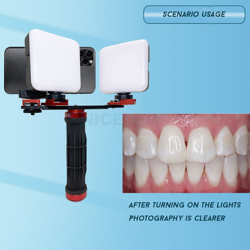 歯科治療ライト,明るさ調整,口腔充填,ツインフラッシュ,携帯電話,歯科写真機器