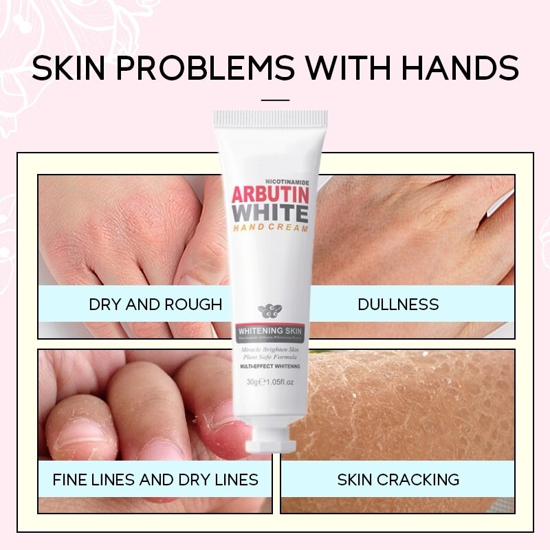 Niacinamide Arbutin Fruit Flavor Hand Cream Whitening Wrinkle Removal Anti-crack Moisturizing Fade Fine Lines Korea Skin Care