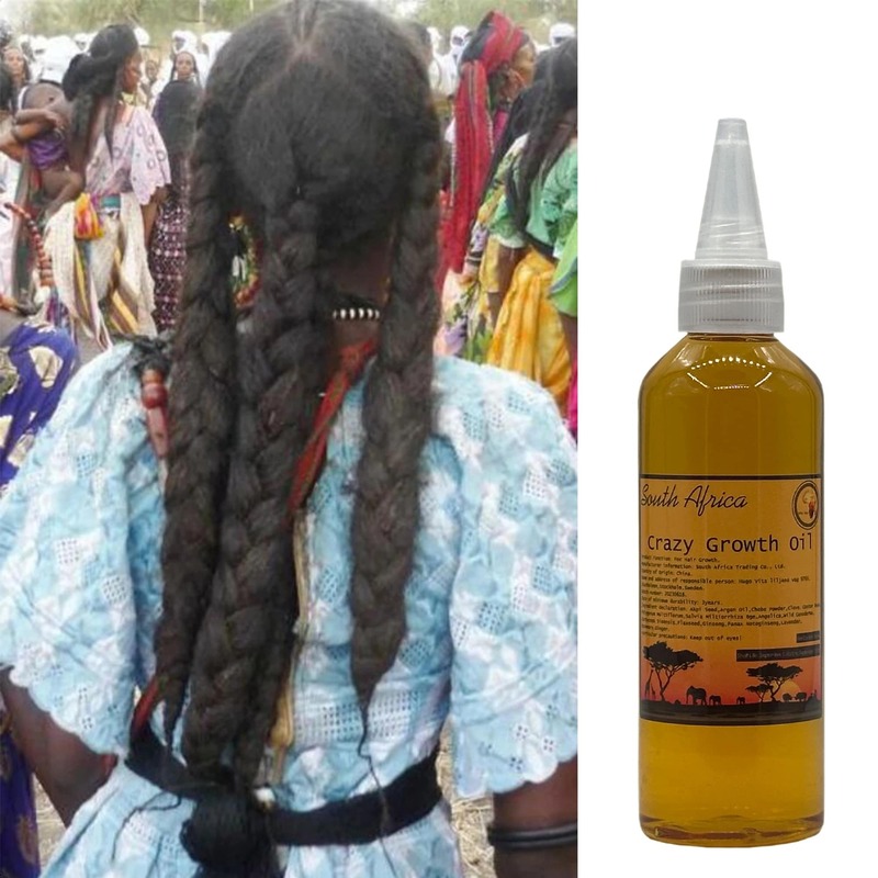 Afrika Hoofdhuid & Haarwortels Versterking Olie Voor Alle Haartypes Haar Groeien Met Rozemarijn Kruidnagel Chebe Olie Gekke Groei Olie