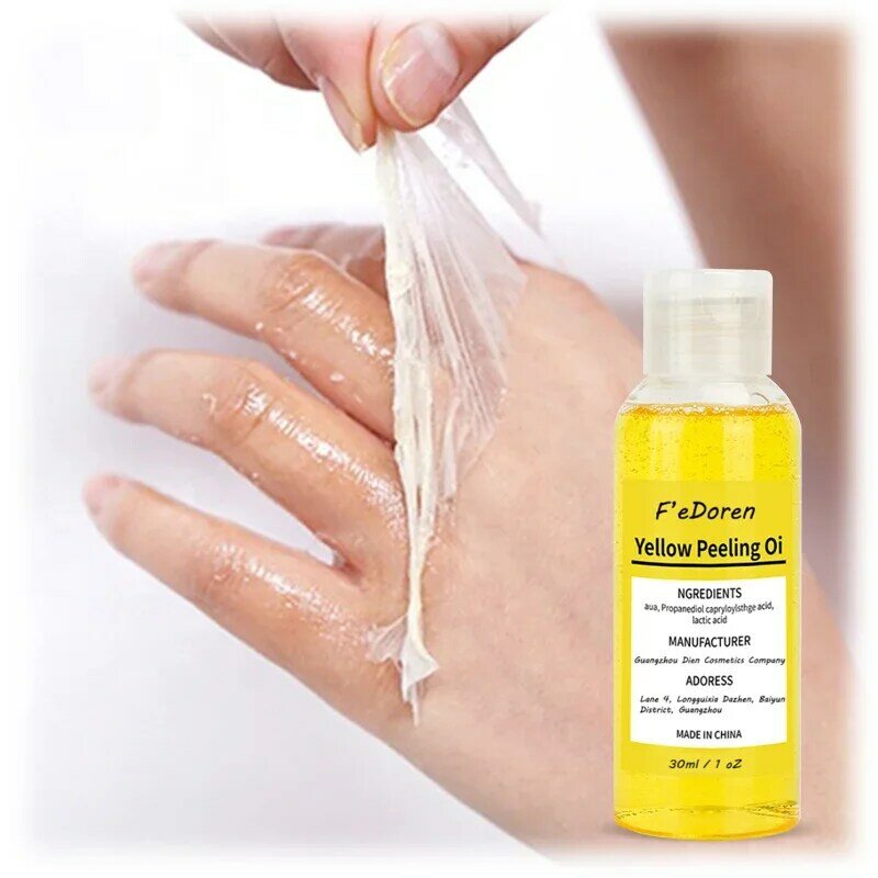 30/50ml Thai yellow peeling oil sbiancamento della pelle scura retinolo con macchie di peptidi punti neri macchie trattamento delle macchie della pelle cattiva