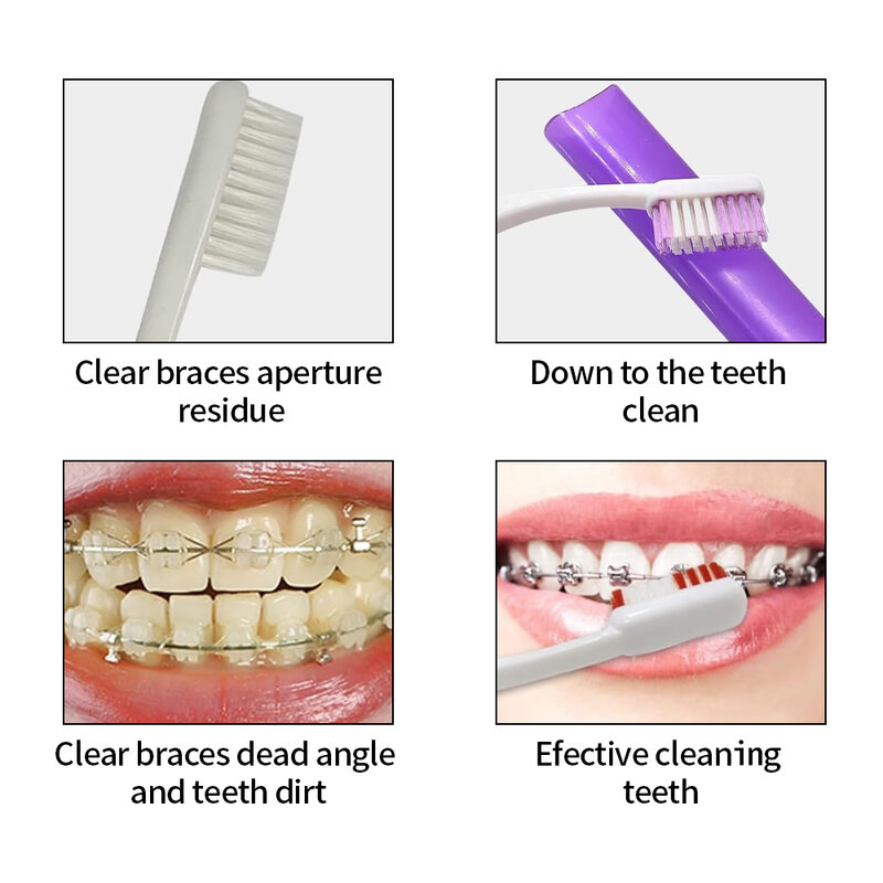8 pz/set cura della pulizia orale strumenti per lo sbiancamento dei denti ortodontici spazzolino da denti Ortho spazzolino interdentale filo interdentale Kit da viaggio