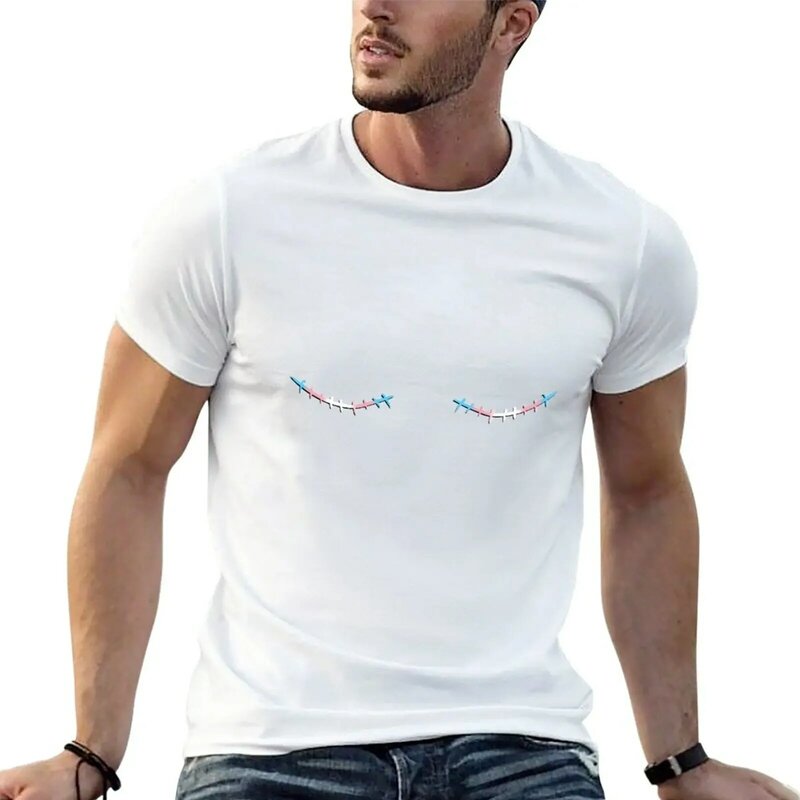 남성용 탑 수술 트랜스 흉터 티셔츠, 헤비웨이트 상의, 일반 블랙 티셔츠