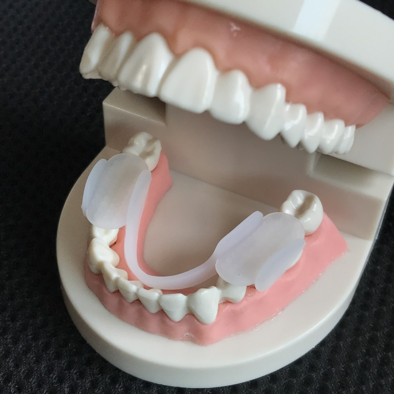 Bruxismo protetor de boca sono protetor de dentes splint clenching dental chaves alinhamento trainer ferramentas protetor de sono