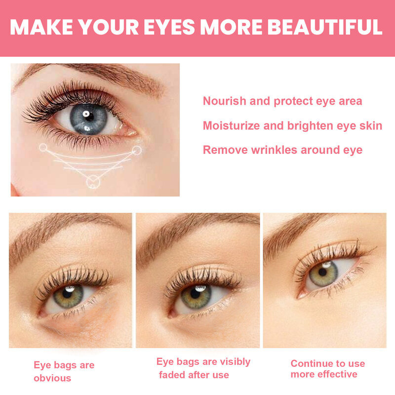 Rosehip Eye Cream Lifting Moisturizing Balm Stick Remove Dark Circles Eye Bags Puffiness Hyaluronic Acid Anti Wrinkle Eye Cream