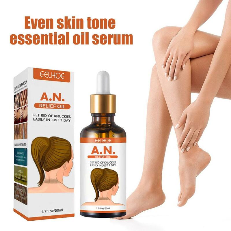 Fast Whitening Cream Intense Stains Remover Dark Knuckles Hand Knuckle Elbows Knee Corrector Serum Beauty Care Products