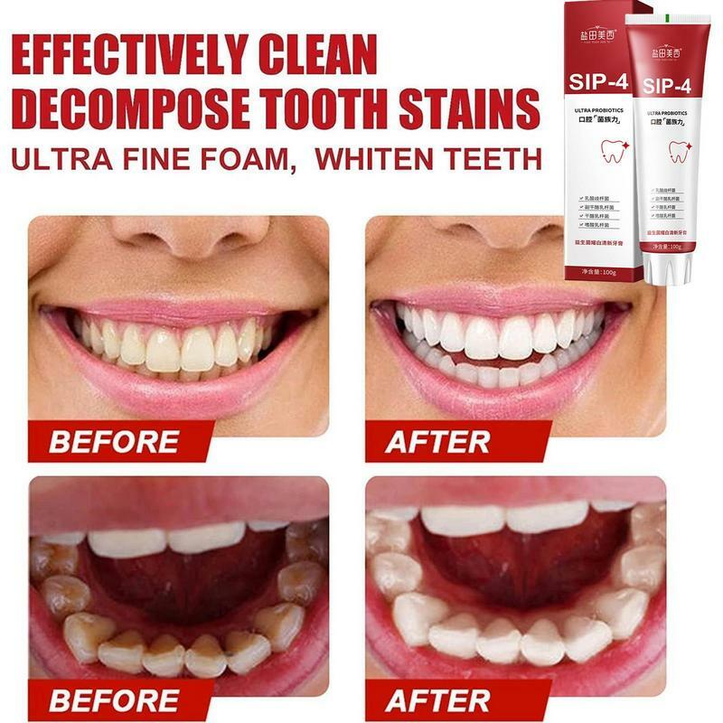 SIP-4ยาสีฟันโปรไบโอติกยาสีฟันสูตรฟันขาวทำให้ฟันขาวขึ้นและขจัดคราบ Sp-4ลมหายใจสดชื่น