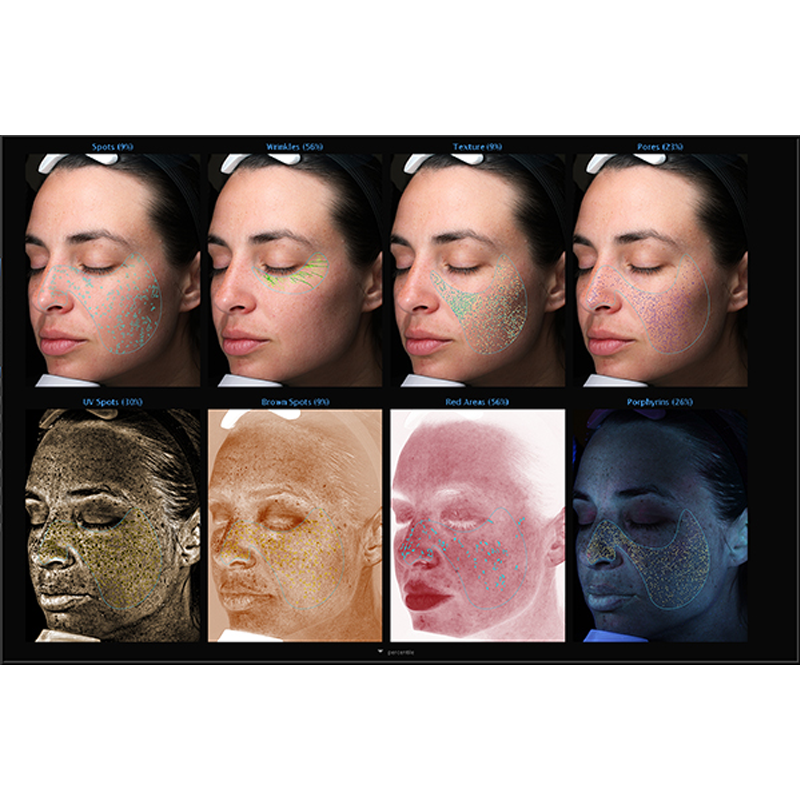 Analisador De Pele Visia GEN7 3D, Scanner Facial Diagnóstico De Problemas De Pele, Tecnologia RBX Patenteada, Equipamento Profissional De Salão De Beleza