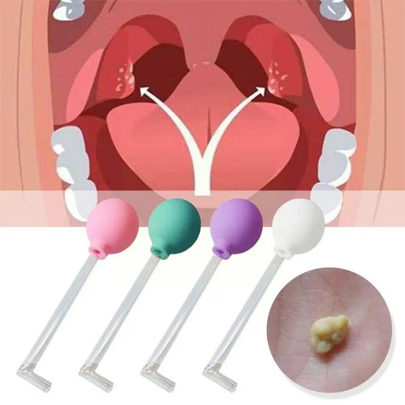Removedor de estilo manual Ferramenta de limpeza bucal Removedor de amígdale Saúde dental para dor de dente Pedra dos dentes, S4P0