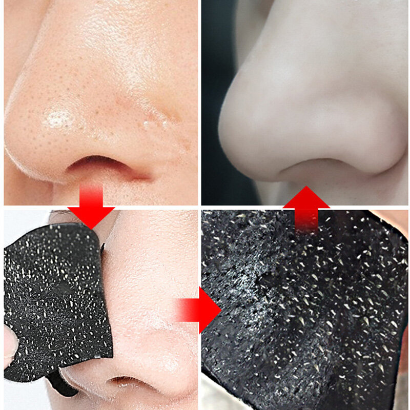 Nase Mitesser Entferner Maske Tiefen reinigung Hautpflege Schrumpfen Poren Akne Behandlung Unisex Maske Nase Schwarzkopf Entferner Werkzeug
