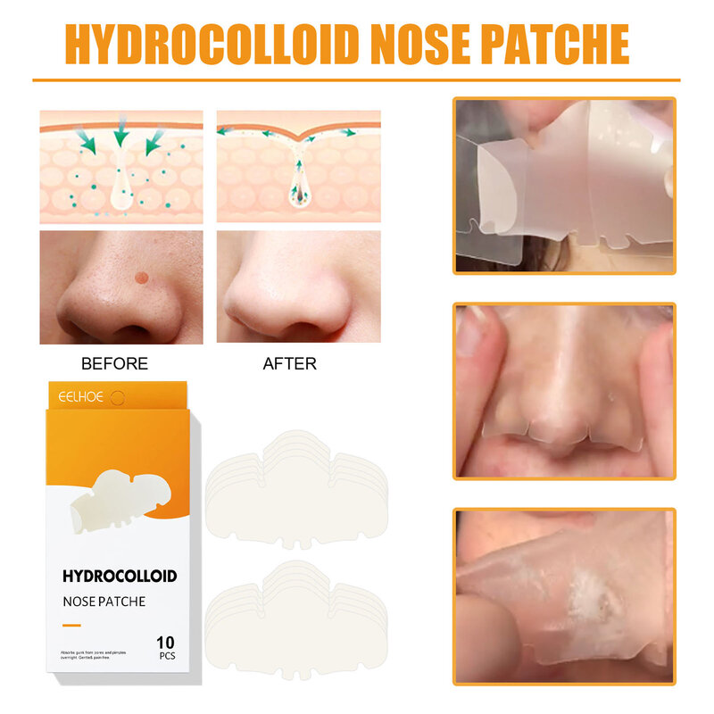 EELHOE-Parches hidrocoloides para eliminación de espinillas, tiras de poros de limpieza profunda para cara, nariz y poros, 10 piezas
