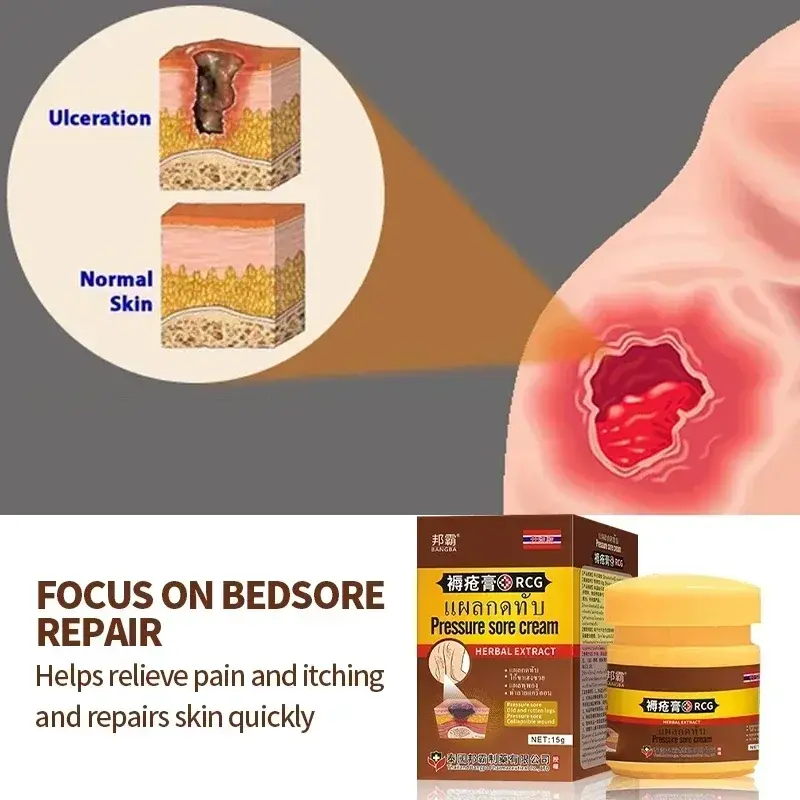 Bedsores Treatment Cream Anti Bed Sore Wound Healing Remove Rot Myogenic Skin Pressure Ulcer Decubitus Thailand Medicine