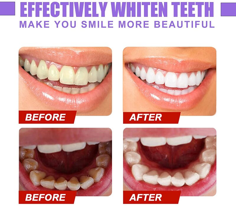 Pasta de dientes para limpieza dental, pasta de dientes para el cuidado del esmalte blanqueador, eliminación de manchas intensivas, Reduce el color amarillo, V34