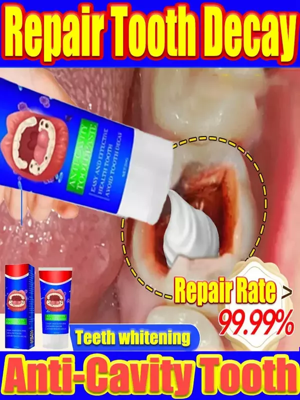 Anti Decay Toothpaste Dental Caries Repair Cream Prevent Tooth Decay Protect Teeth Remove Plaque Toothache Relieve Periodontitis