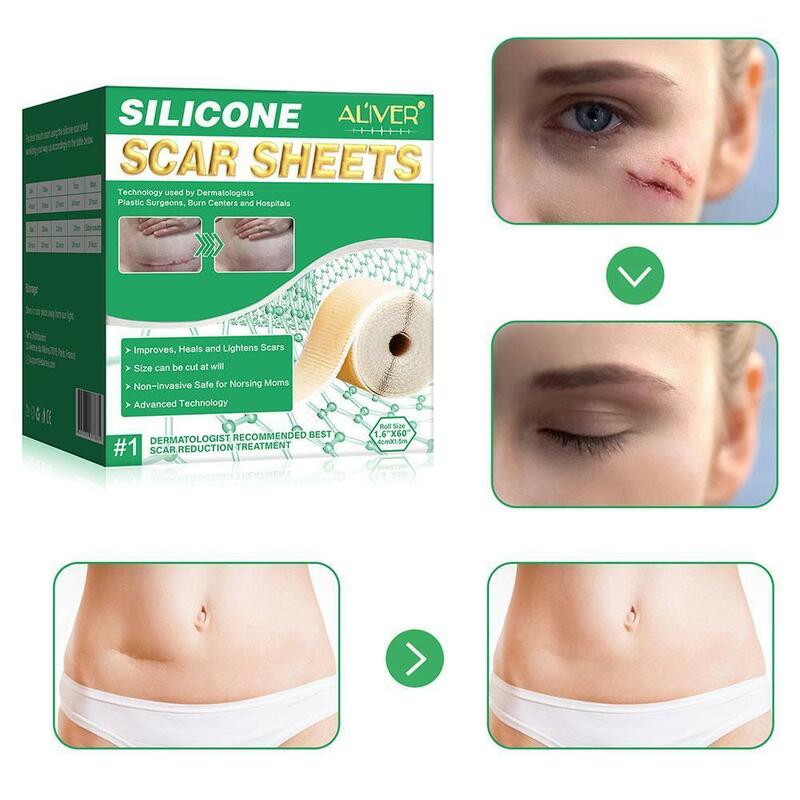 Acne Surgical Stretch Marks Removal Scar Cream Pimples Patch Self-adhesive Skin Tone Gel Spot Burn Repair Tape Acne Face F3Y2