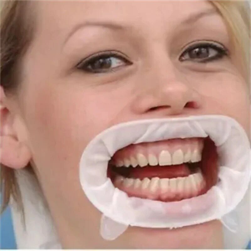 Pembuka mulut gigi Optra Gate 3D bibir, instrumen gigi Oral bibir alat dokter gigi