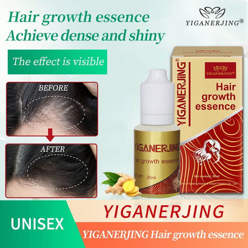 Yiganjing-髪の成長のための流体,天然の美容オイル,中国のセックスと頭皮のケア,新しい,20ml, 5個