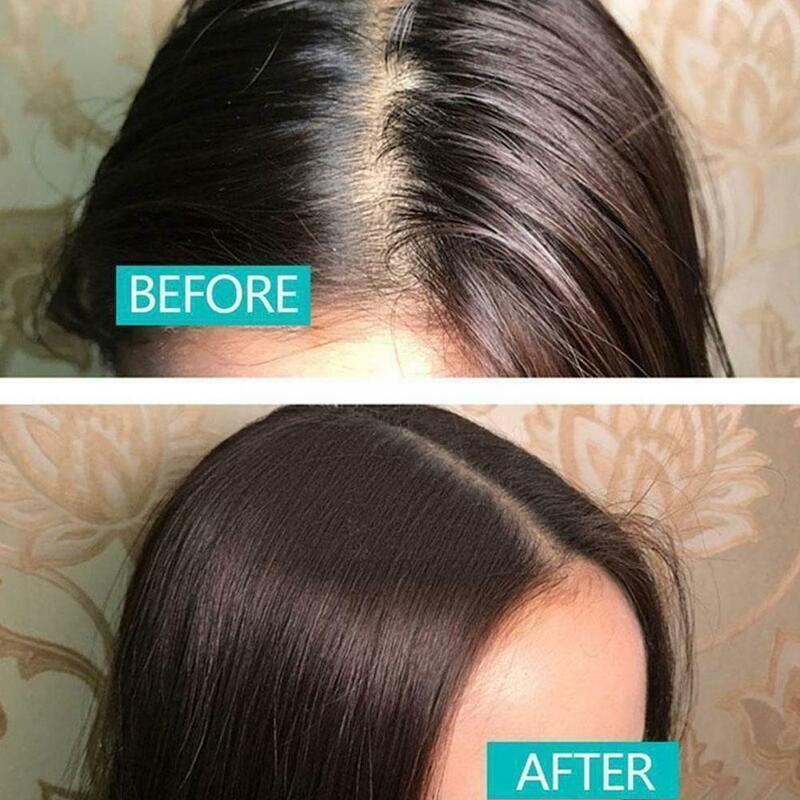 Flauschiges Haar puder schnell absorbieren Fett entfernen Geruch erhöhen feuchtigkeit spendende Pflege sauber 10g Styling Haar erfrischendes Haar produ b2l4