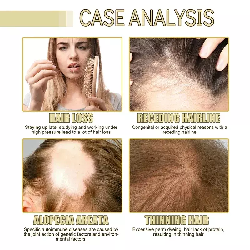 Natürliches Haarwuchs öl effizient gegen Haarausfall pflegendes ätherisches Öl für dichte Reparatur beschädigtes Haar feuchtigkeit spendendes glattes Öl