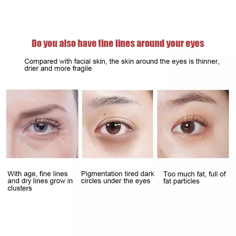 Krim mata Anti Keriput Retinol, krim perawatan mata mengurangi garis halus Anti lingkaran hitam menghilangkan kantung mata Anti Penuaan mengencangkan