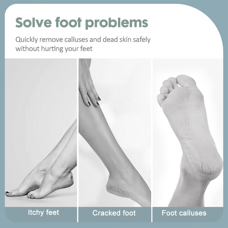 KK Pedicure due lati strumenti per la cura dei piedi lima per piedi professionale Rasps callo piede rimozione della pelle morta set di bellezza salute