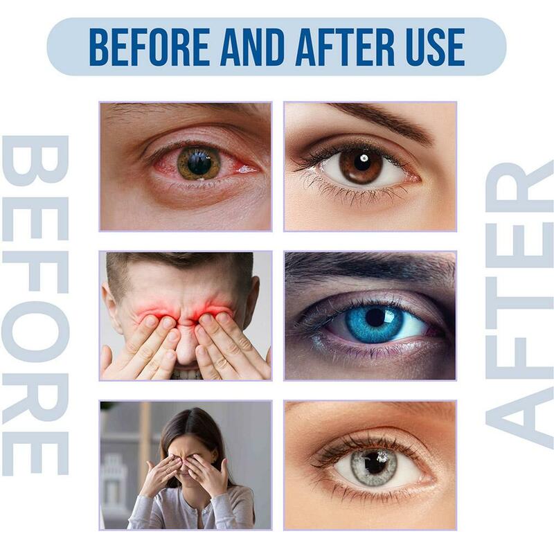 Eye Drops for Health Massage Removal Care, Colírio fresco, Desintoxicação dos olhos, Alivia a fadiga ocular, Relax Discomfort Products, 1PC, 15ml