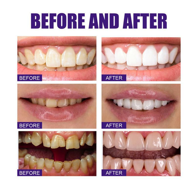 歯磨き粉の紫色の歯磨き粉,汚れを取り除き,呼吸し,ケア,美白,歯磨き粉,v34,30ml
