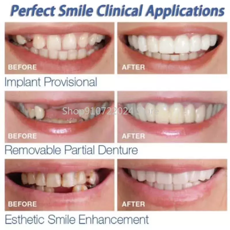2 Buah/Set Set Gigi Silikon Pemutih Gigi Penutup Kawat Gigi Simulasi Gigi Palsu Gigi Atas Gigi Bawah dengan Kotak Senyum Sempurna