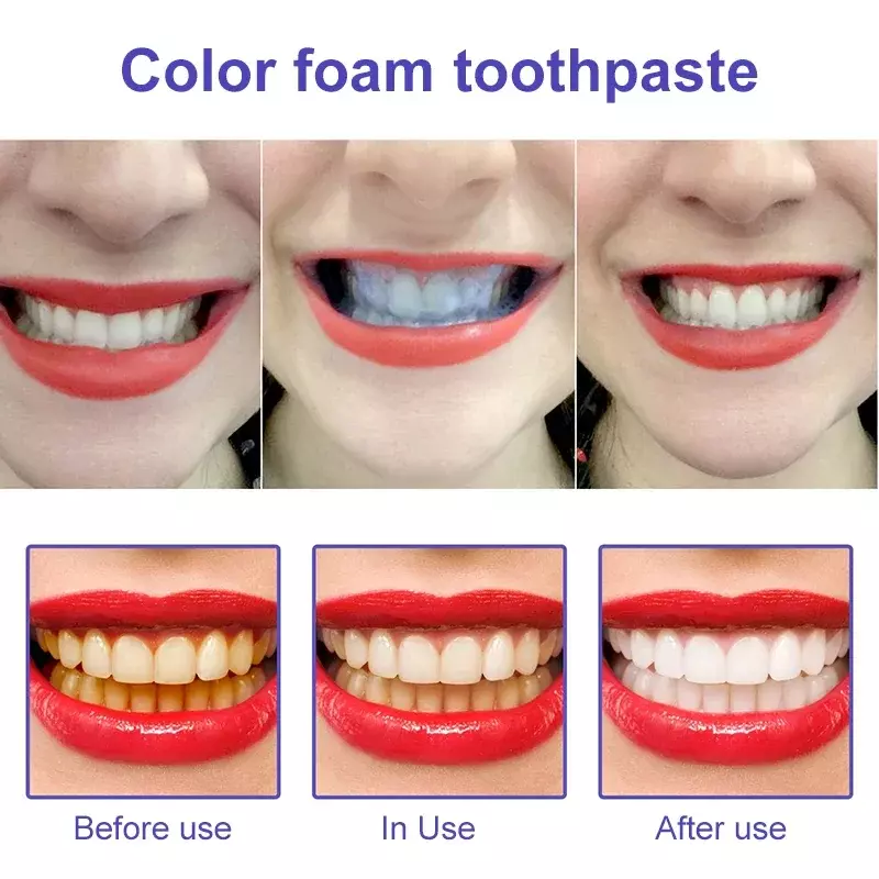V34 smileEASE dentifricio sbiancante viola rimuovi macchie riduce l'ingiallimento cura per i denti gengive alito fresco denti schiarenti 30ml