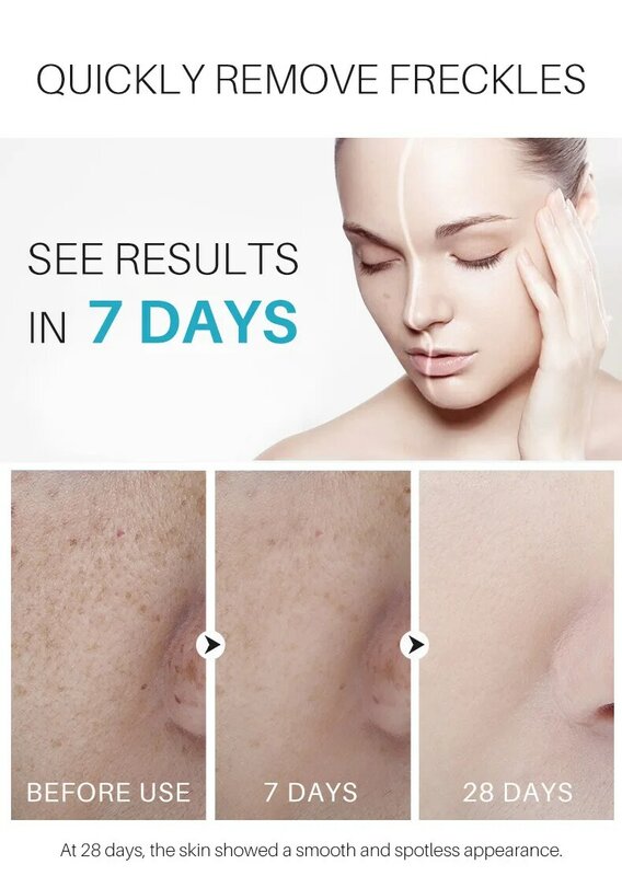 Best Age Spot Remover Whitening Freckles Anti-aging Face Skin Care Remove Dark Spots Night Cream