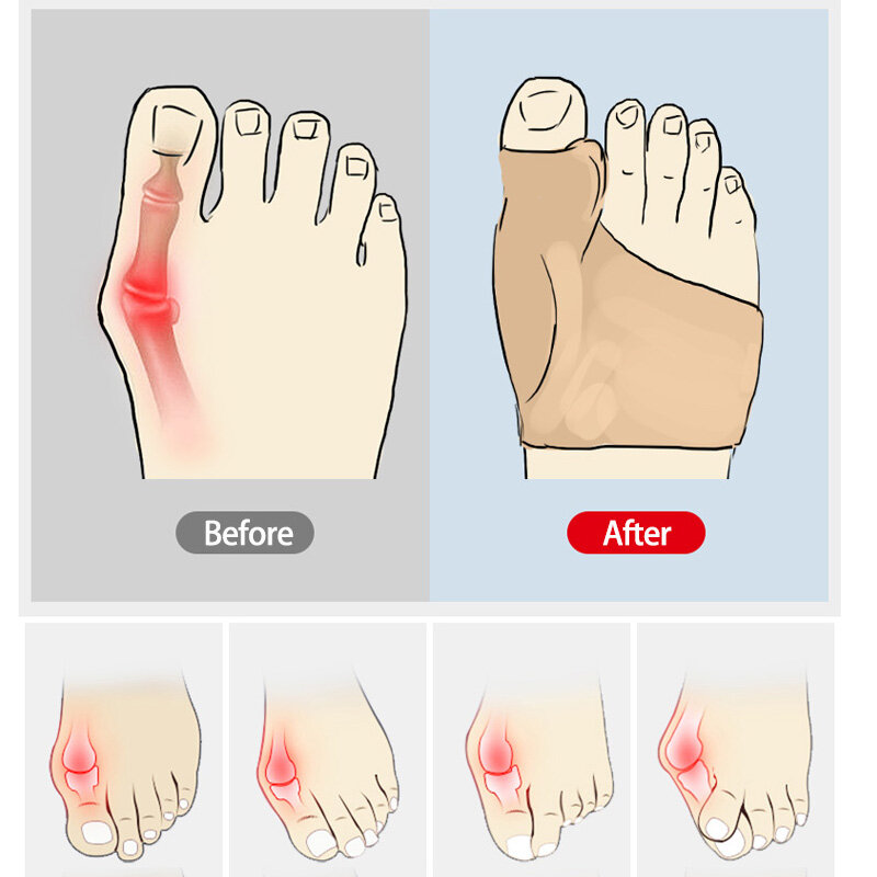 Korektor haluksów korektor korekcyjny dla kobiet Separator palców stopy separatory palców stóp palucha koślawego korektor