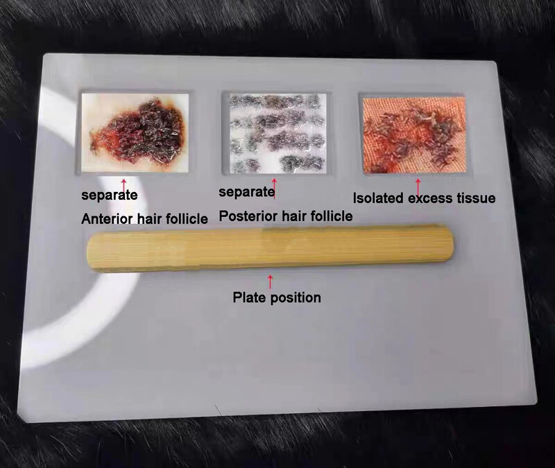 Hair Follicle Separation Plate Separation Plate