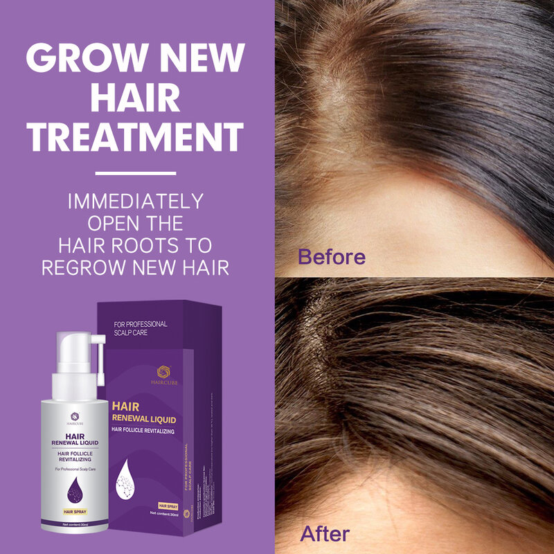 Hair Growth Product for Men/Women Anti Hair Loss Treatment Ginger Hair Regrowth Spray Repair Damaged Hair Roots Essence Original