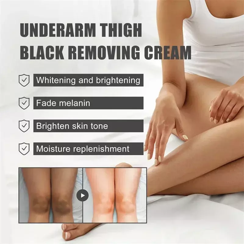 White ning Cream Private Teile Achsel Bleichen Serum Weiß Hintern Knie aufhellen inneren Oberschenkel intime Teile dunkel entfernen Melanin