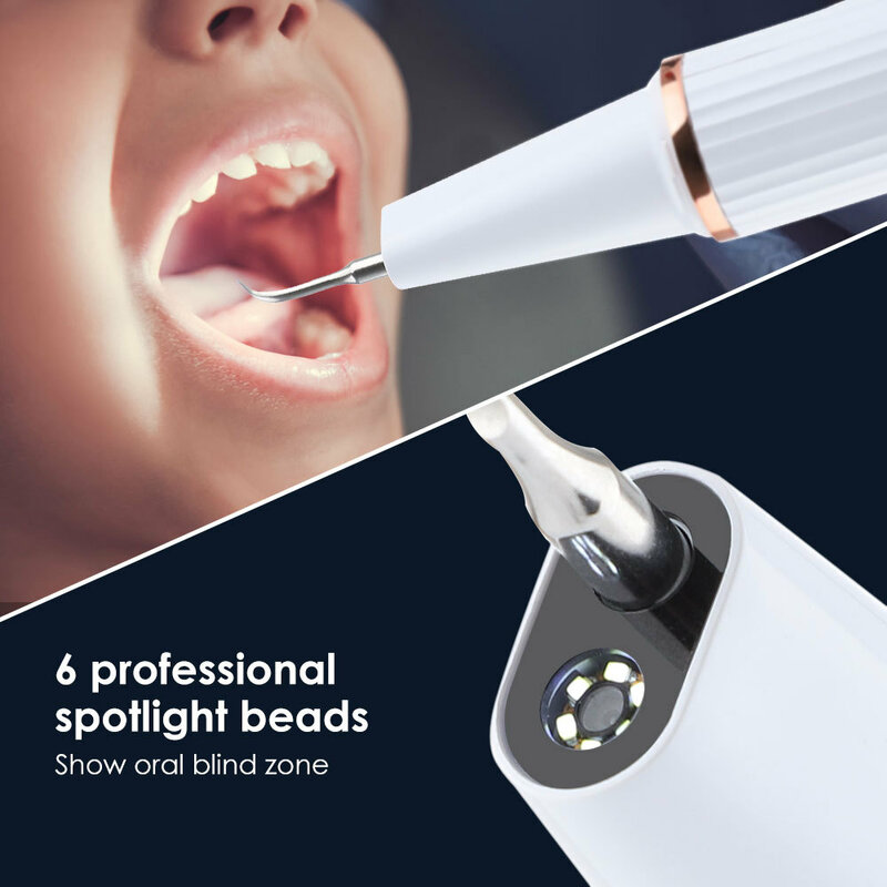 Visual Ultrasonic Dental Cleaner  Dental Stone Removal  Electric Dental Beauty Instrument  Tooth Removal  Whitening Instrument