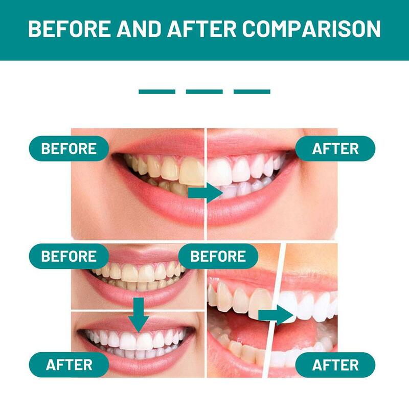 Tanden Reinigende Mousse Verwijderen Tandplak Vlekken Adem Tandpasta Verfrissen Tandschuim Cariës Orale Whitening Reparatie Hygiëne A9b7