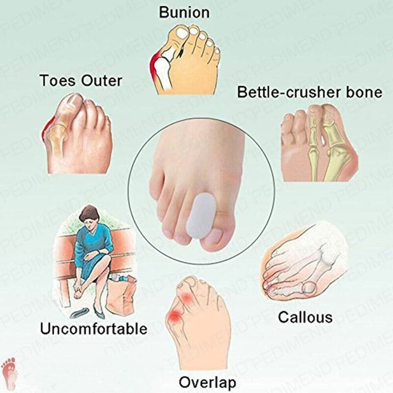 Separatore per dita in Gel per alleviare il dolore cura del piede Unisex distanziali per dita protezione per le dita dei piedi separatore per dita sovrapposte in Silicone piede
