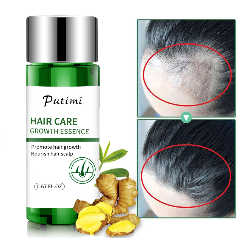 Hair Growth Serum Hair Fast Hair Growth Products Prevent Hair Loss Damaged Hair Repair Natural Hair Care Men Women 30ml TSLM1