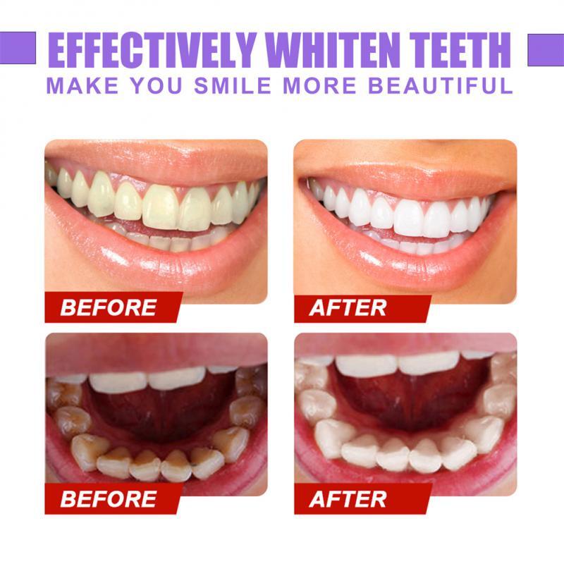 V34 Purple dentifricio pressa in bottiglia dentifricio Gel per denti per sbiancamento dei denti schiarente riduce l'ingiallimento pulizia cura dei denti