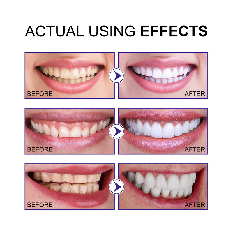 Sbiancamento dei denti in polvere sbiancante migliora la rimozione del raso della placca dentale proteggi la gomma igiene orale alito polvere pulita per denti freschi