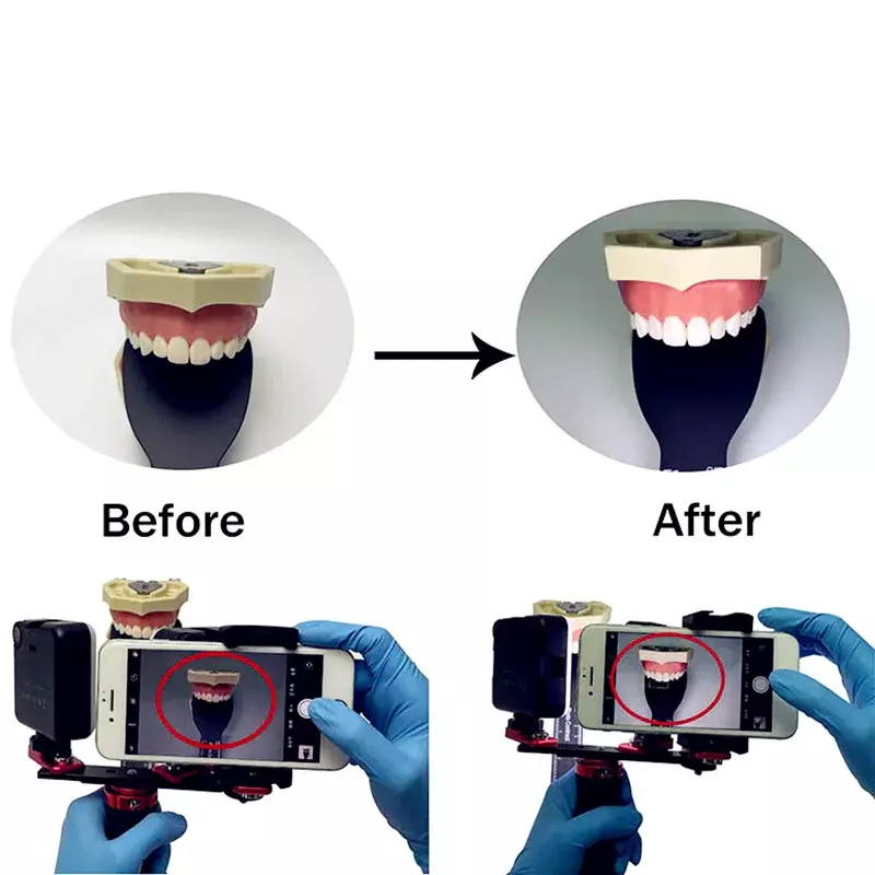 Diskon besar lampu pengisi mulut dengan ponsel, dengan 2 LED/kamera pemegang lampu kilat fotografi untuk dokter gigi