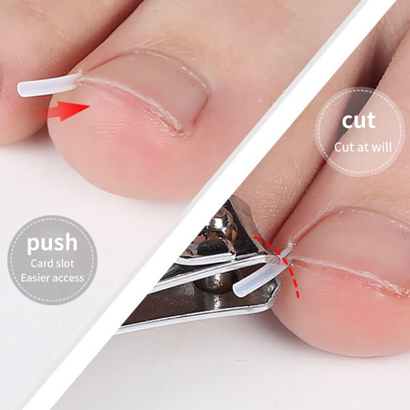50Pcs Ingrown Toenail Correction Tool Ingrown Toe Nail Treatment Elastic Patch Sticker Straightening Clip Brace Pedicure Tool