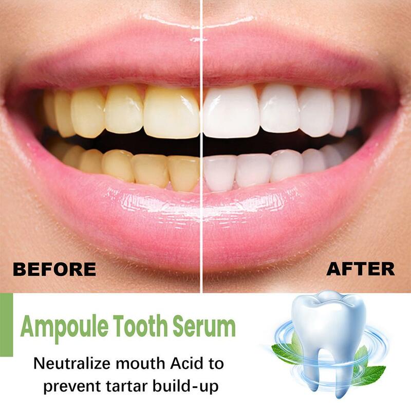 ฟอกสีฟันยาสีฟันธรรมชาติ10ชิ้นทำความสะอาดล้ำลึกทำให้ฟันขาวขึ้นรสมิ้นท์ดูแลสุขภาพช่องปาก