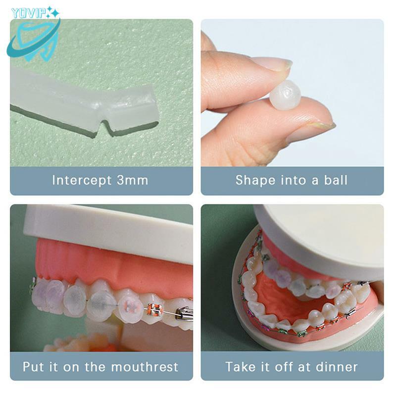 Dental Orthodontics Mint Mix Perfume para Aparelhos, Ortho Wax, Bracket Gum Irritação, Clareamento Dental, Ferramentas de Higiene Oral, 5 pcs por caixa