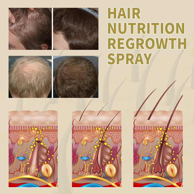 Spray de rebrote para nutrición del cabello, tratamiento para el crecimiento del cabello, esencia rápida y efectiva, suero de regeneración para el cuidado del cabello