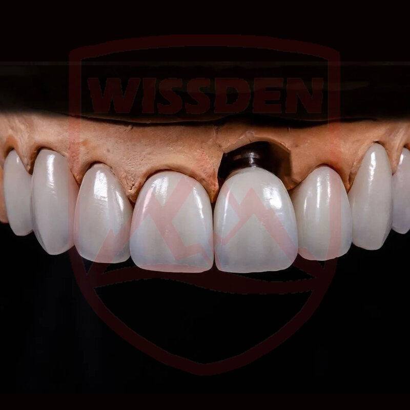 Wissden dental lab materialien mehr schicht ige zirkon oxid blöcke 3d 98,12-30mm cad/cam