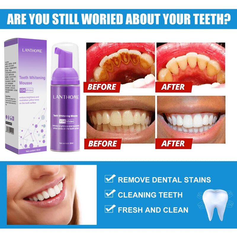 V34 Dentes Branqueamento Mousse Creme Dental, Remover manchas de placa, Limpeza, Higiene Oral, Branqueamento Dental Tools, Hálito Fresco, Cuidado Dental