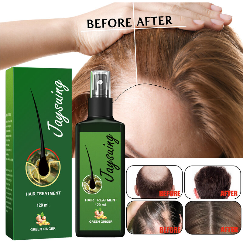 Haarwuchs Spray effektiv pflegende Wurzel Haar dickes Wachstum Flüssigkeit Anti Haarausfall Ingwer Anti-Fall Kopfhaut Massage Reparatur spray