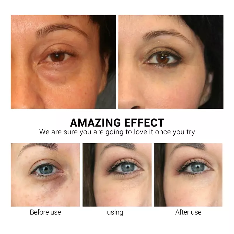 60pcs Vitamin c eye mask eye patch essence removes eye wrinkles under the eyes improves dark circles tightens and brightens