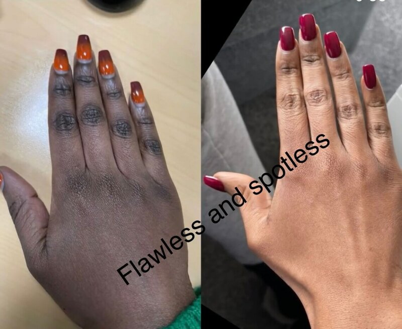 Dark Knuckles Remover Eraser, Clear Knuckles Cream for Hands Fingers Feet
